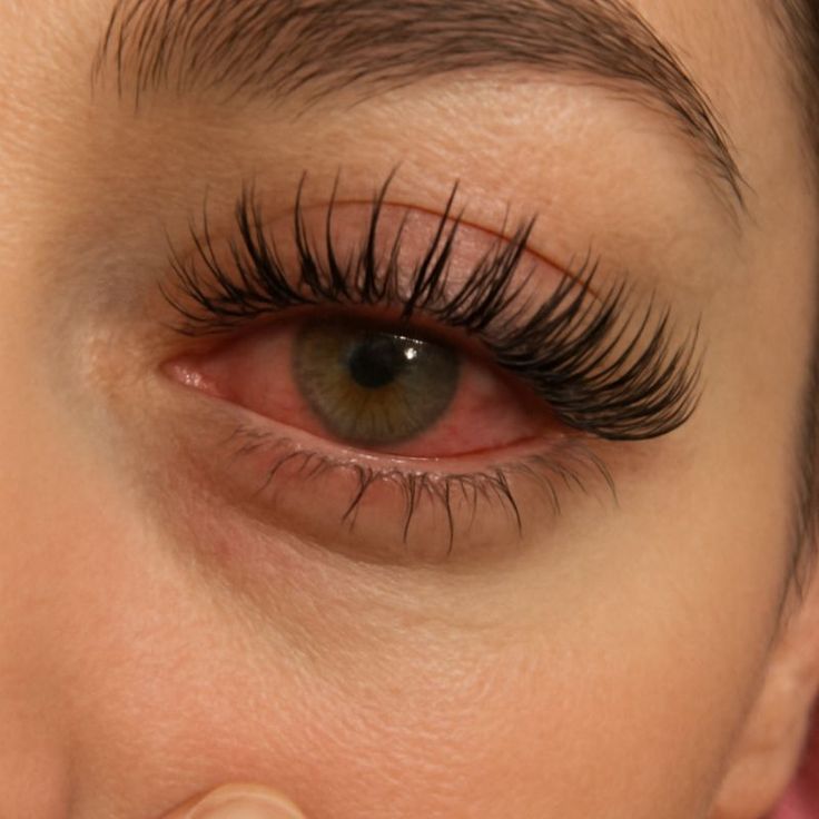 Rubbing Your Eyes
